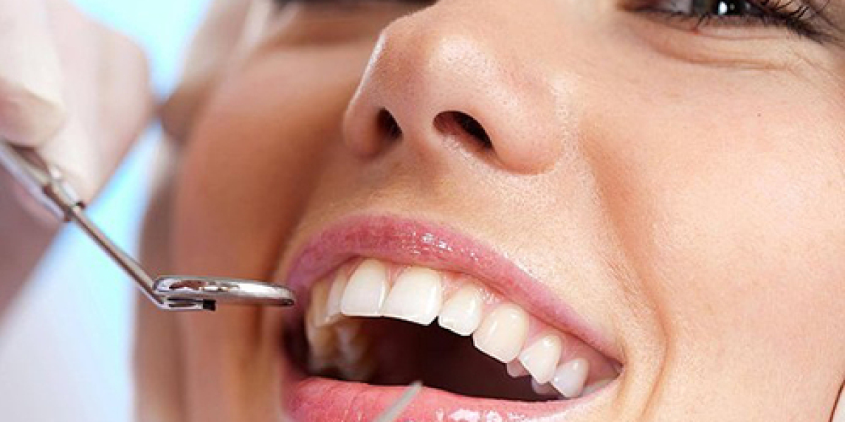 Fixed Dentures in Tampa: A Comprehensive Guide to a Permanent Smile Solution
