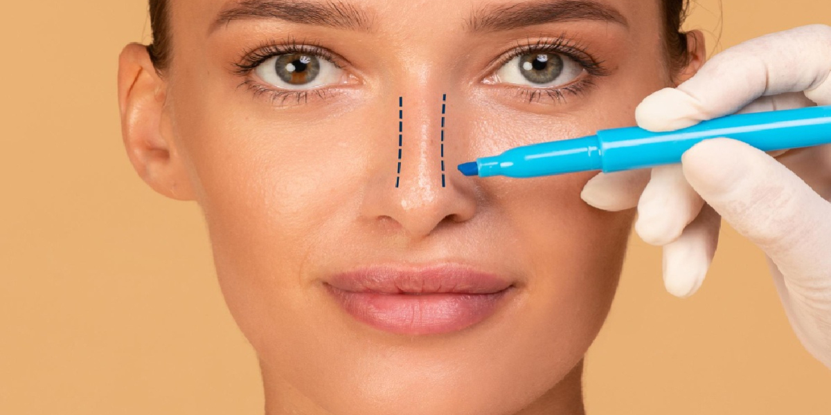 Revision Rhinoplasty in Turkey: Affordable Solutions to Complex Cosmetic Challenges