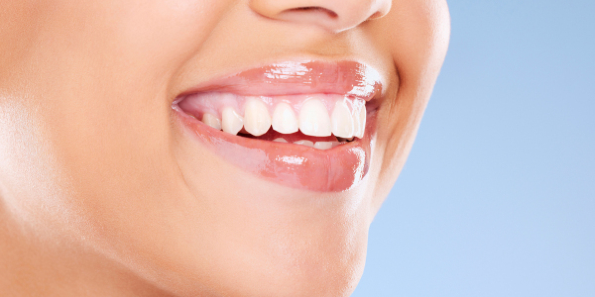 What is Zoom Teeth Whitening, and How Does it Work?
