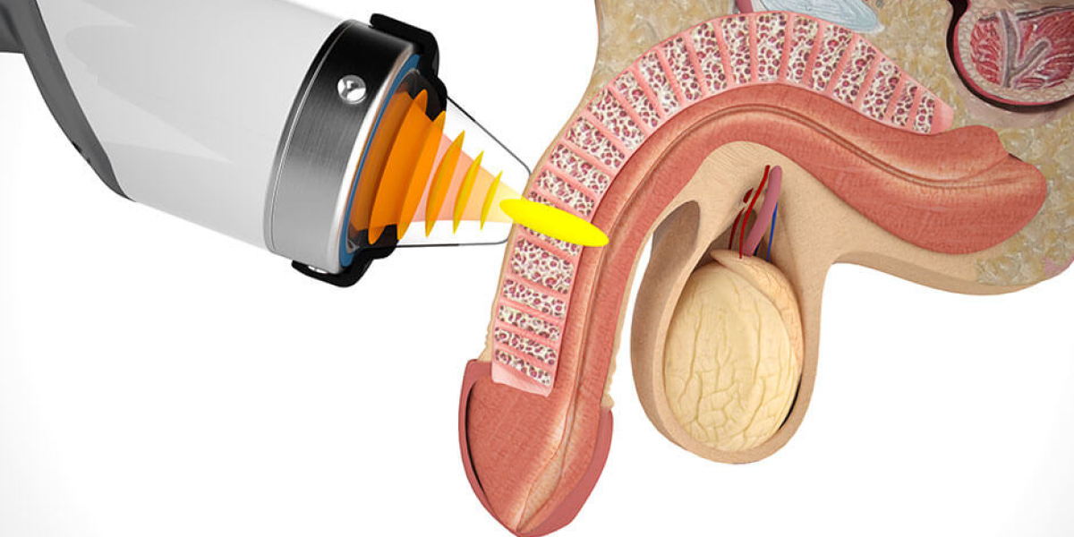 Erectile Dysfunction (ED): Causes, Diagnosis & Treatment