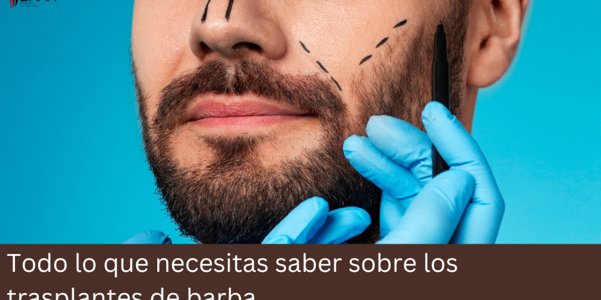 Todo lo que necesitas saber sobre los trasplantes de barba