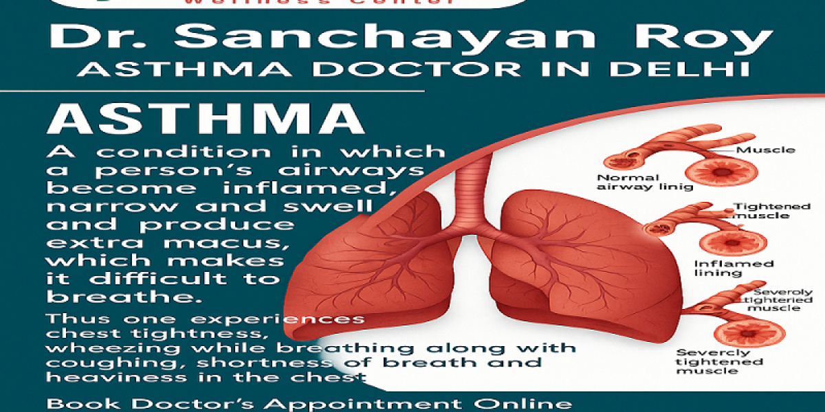 Consult the Best Asthma Specialist Doctor Near Me for Long-Term Solutions