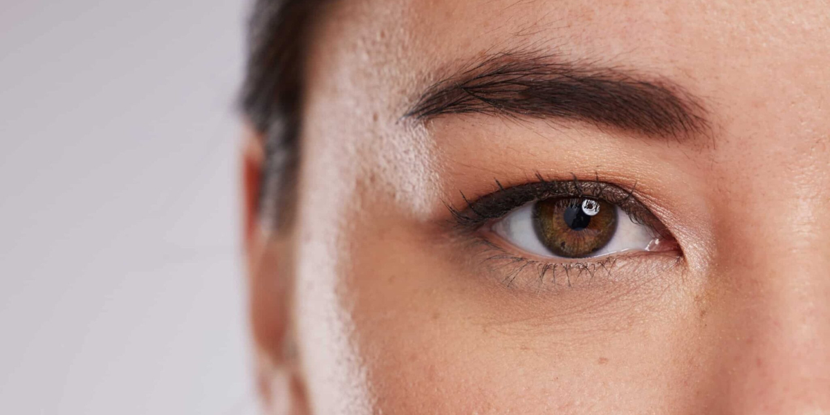 Upper Blepharoplasty Dubai: Achieve a Refreshed, Youthful Look Without Downtime