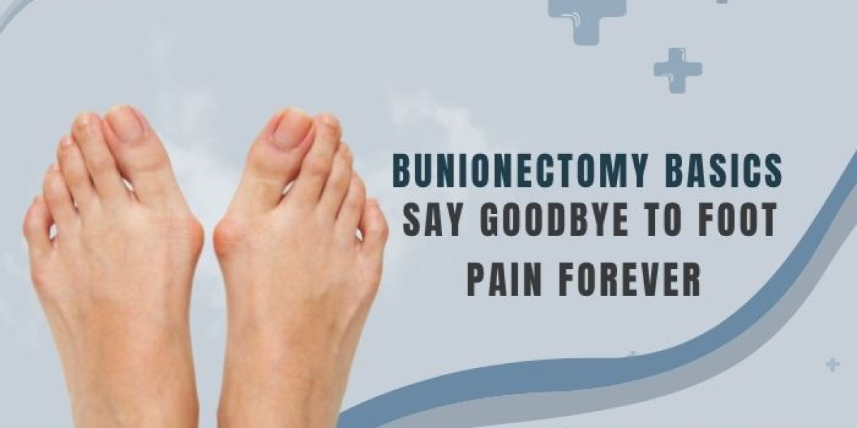 Choosing the Right Bunion Pain Treatment for You