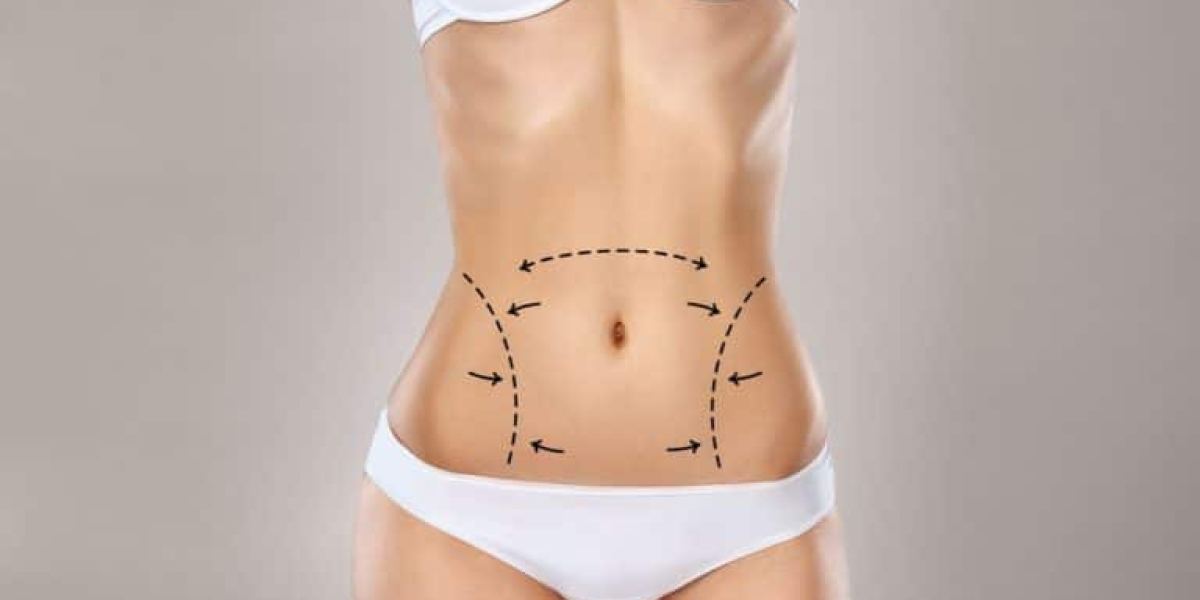Liposuction in Dubai vs. Non-Surgical Fat Reduction Treatments