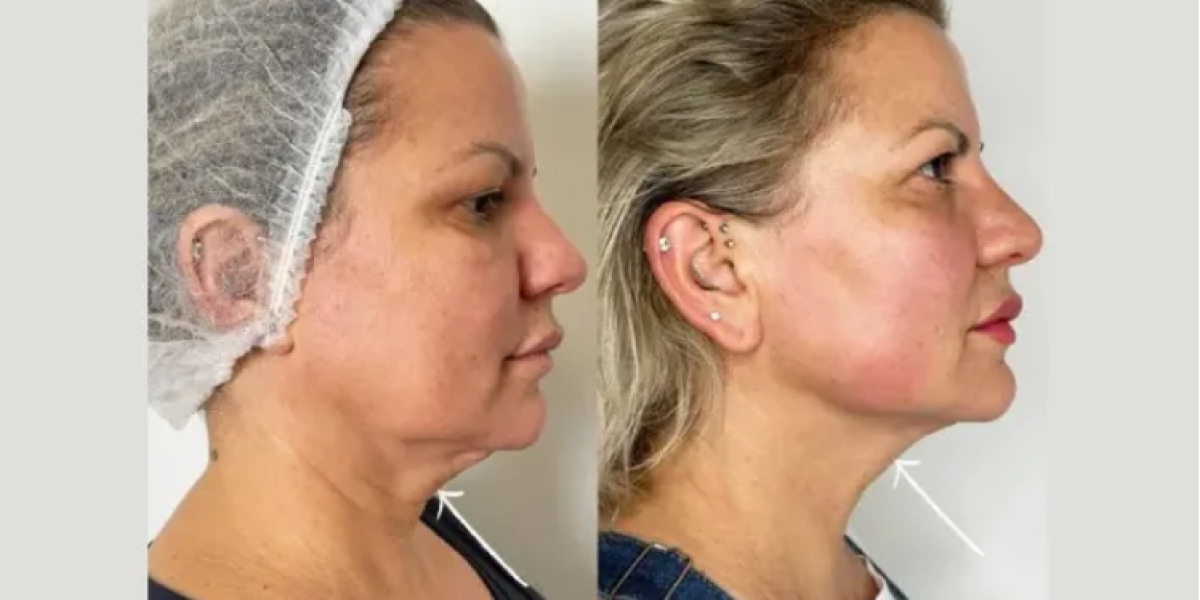 Best Plastic Surgeons in Dubai for Cutting-Edge Treatments