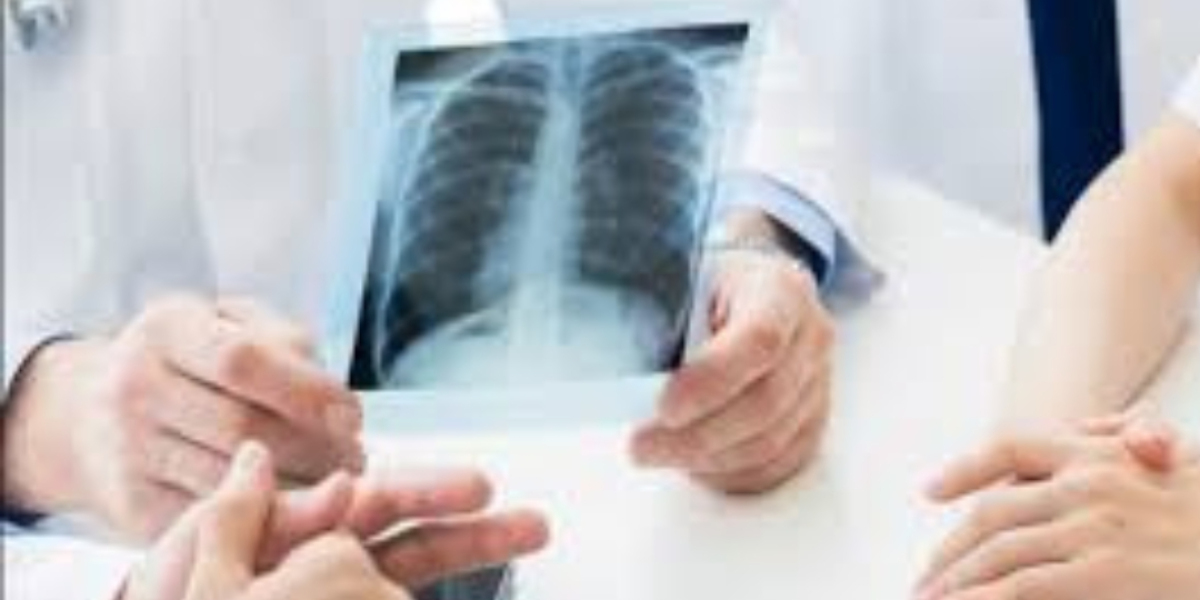 Digital X-Ray Near Me – Your Complete Guide to Modern Imaging Solutions
