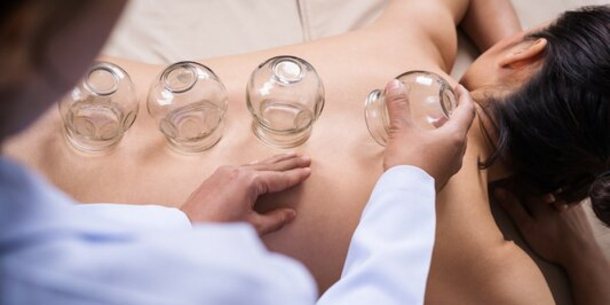 Cupping Massage Boston: Ancient Healing Meets Modern Wellness