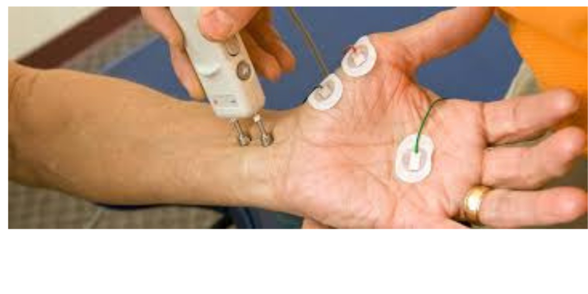 NCV Nerve Test in Bangalore: A Complete Guide to Diagnosis, Benefits & Procedure