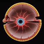 Retinitis Pigmentosa