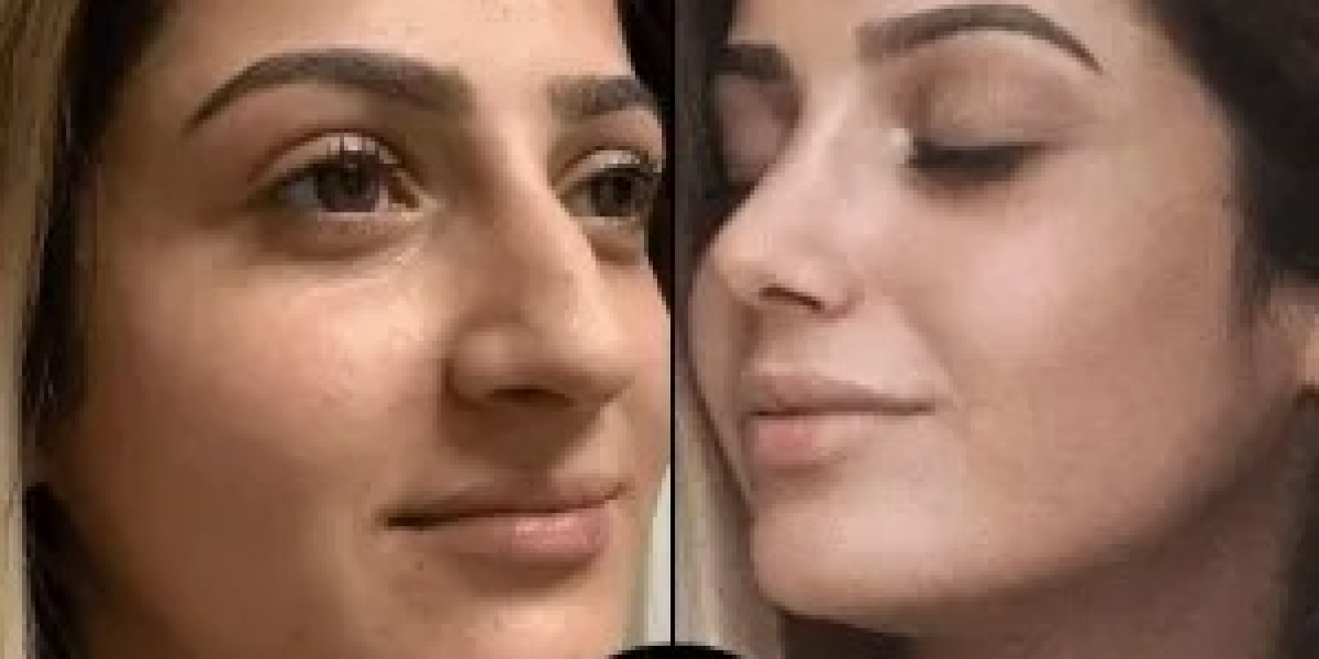 Best Plastic Surgeon in Dubai for Revision Surgeries Done Right