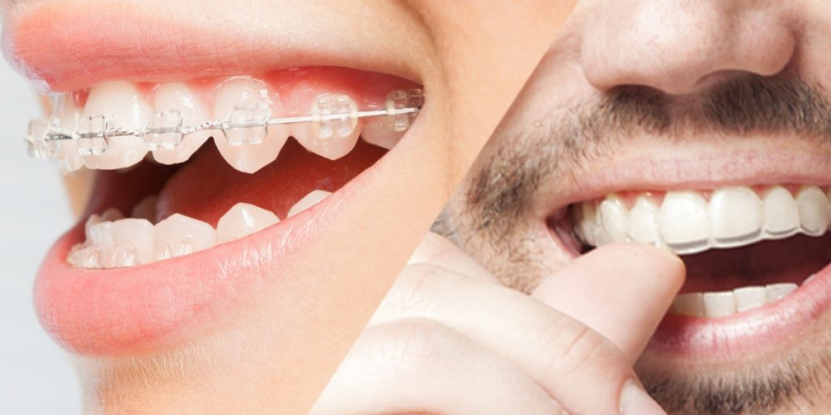 Chapel Street Dental’s 7 Secrets to Perfect Oral Health