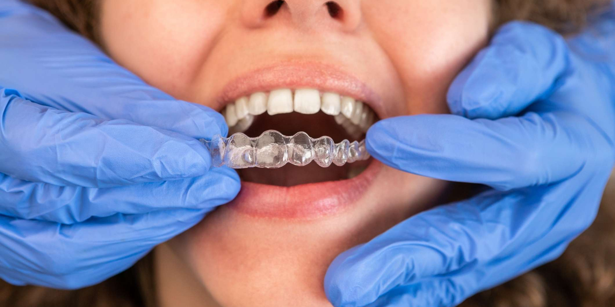 Morning vs. Night Aligners: When Is the Best Time to Switch Trays?