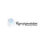 Hyperpigmentation UK
