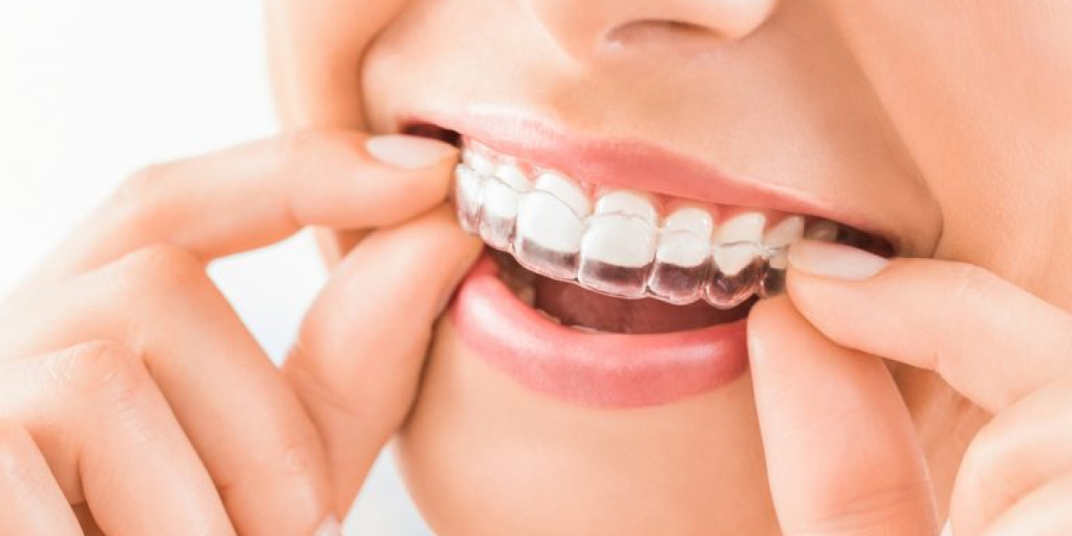 Invisalign Braces Dubai for Clear and Comfortable Alignment
