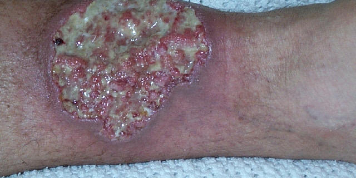 The Role of Nutrition in Managing Pyoderma