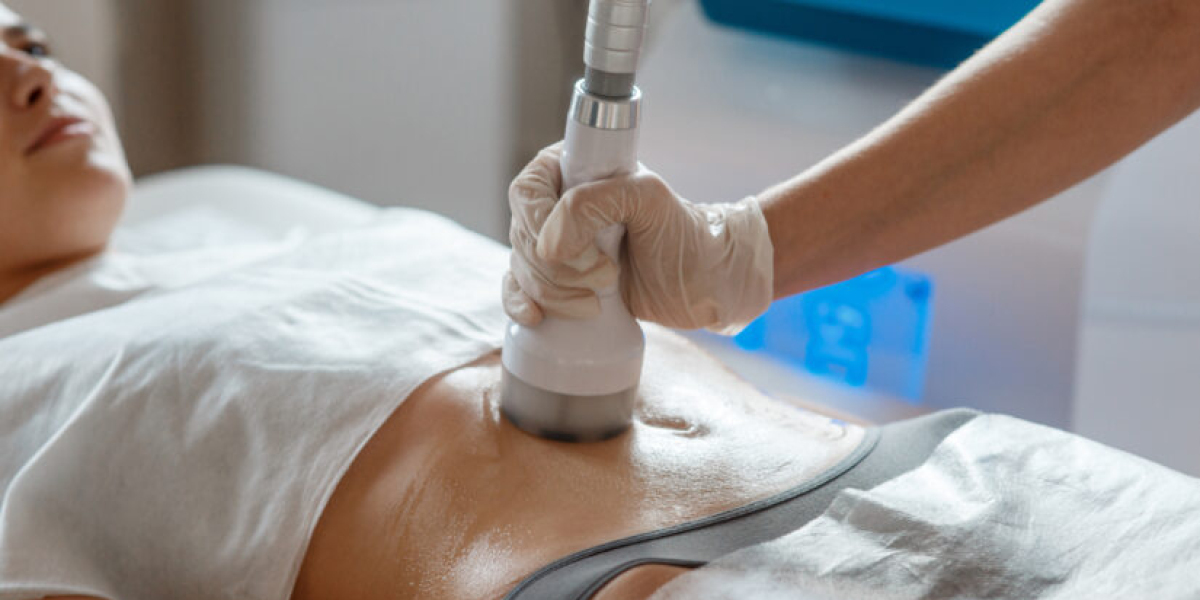 How Laser Liposuction Can Sculpt Your Body Safely