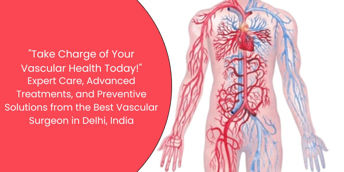 Top 10 Reasons to Visit a Vascular Surgeon in India – Affordable, Expert, and Life-Saving Care