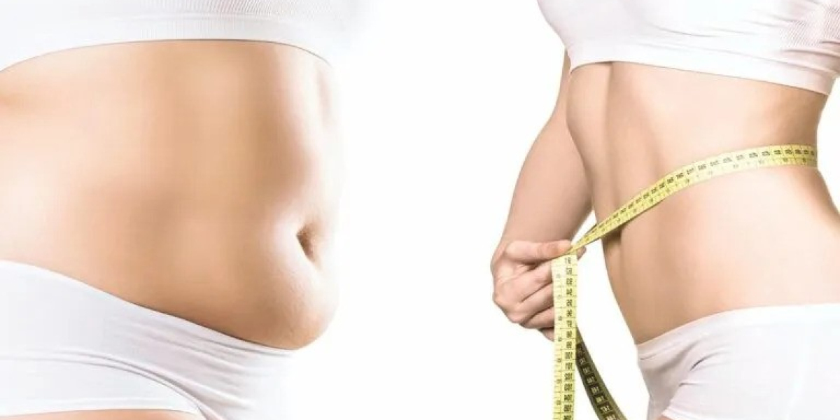 Why More People Are Choosing Body Contouring in Dubai for Total Transformation