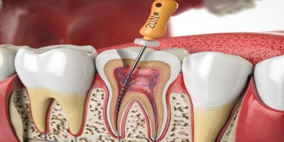 Revitalize Your Smile: Comprehensive Solutions for Tooth Health and Restoration