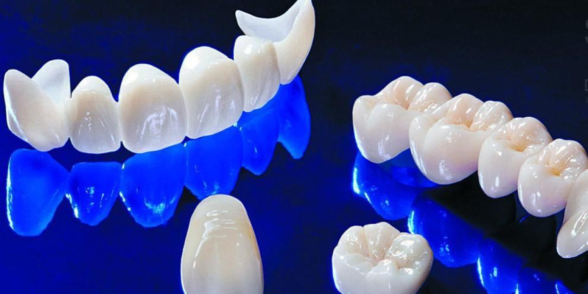 Zirconia Crowns vs. Porcelain Crowns: Islamabad Expert Advice