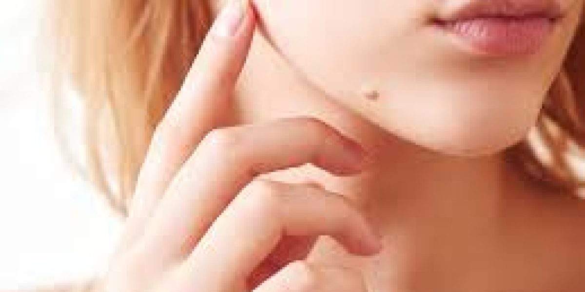 How Long Does It Take to See Improvements After Mole Removal?