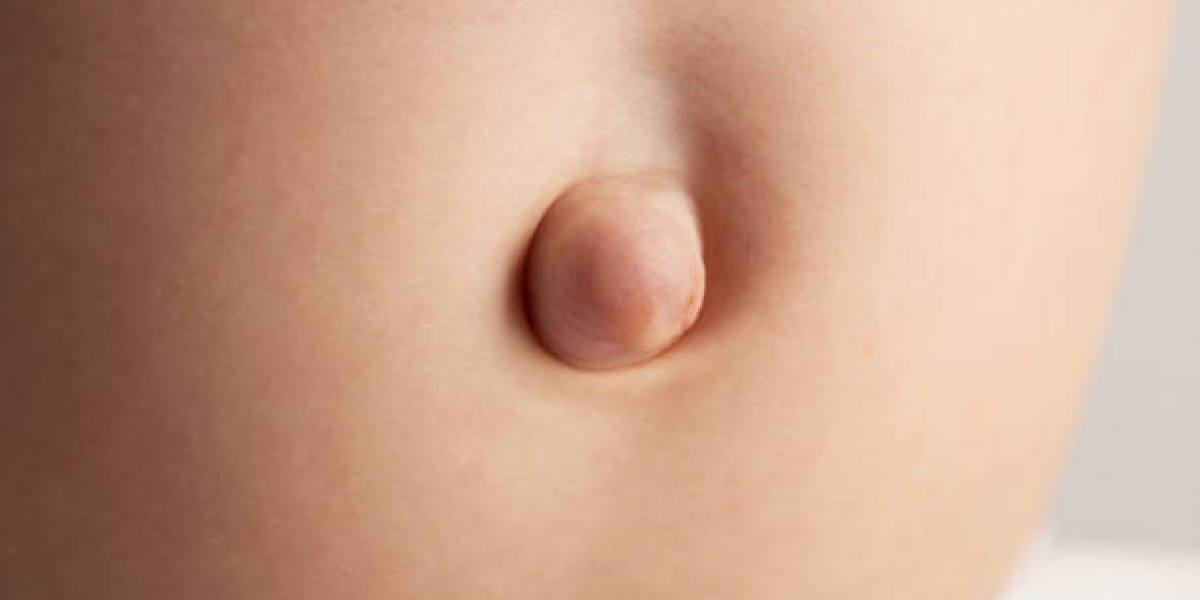 Common Myths About Hernia Surgery Debunked