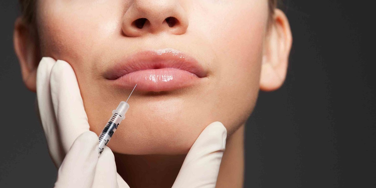 The Science Behind Hyaluronic Acid in Lip Augmentation