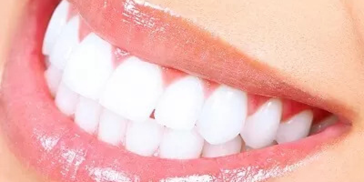 The Best Teeth Whitening Products Recommended in Islamabad
