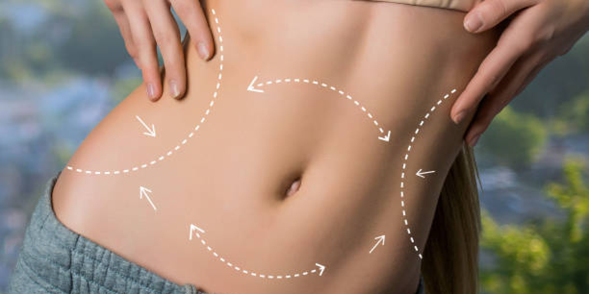 How Does Liposuction Procedure Prepare the Body?