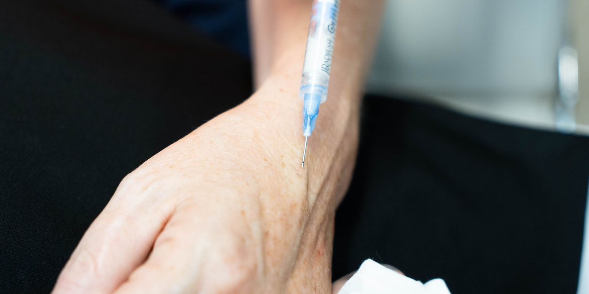 Is CO2 Hand Rejuvenation Safe for All Skin Types?