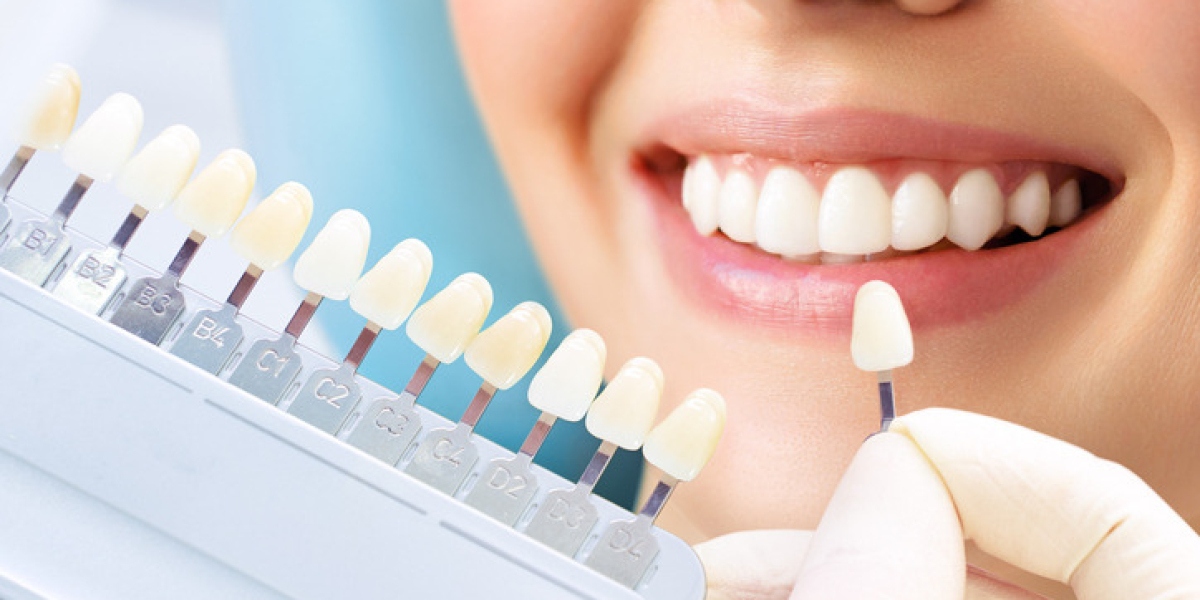 Italian Dental Clinic Dubai with World-Class Care