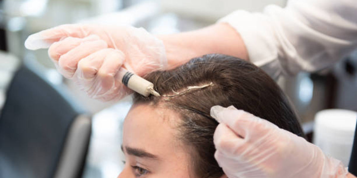 Riyadh's PRP Hair Treatment for Fuller Locks Ahead