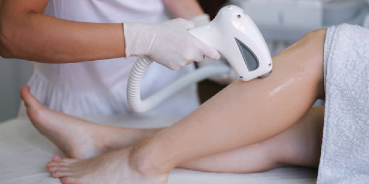 Preparing Your Skin for Laser Hair Removal Sessions