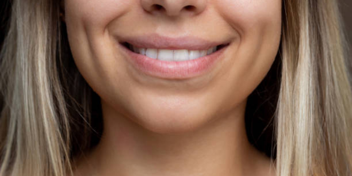 Exploring Different Methods of Dimple Creation and Their Outcomes
