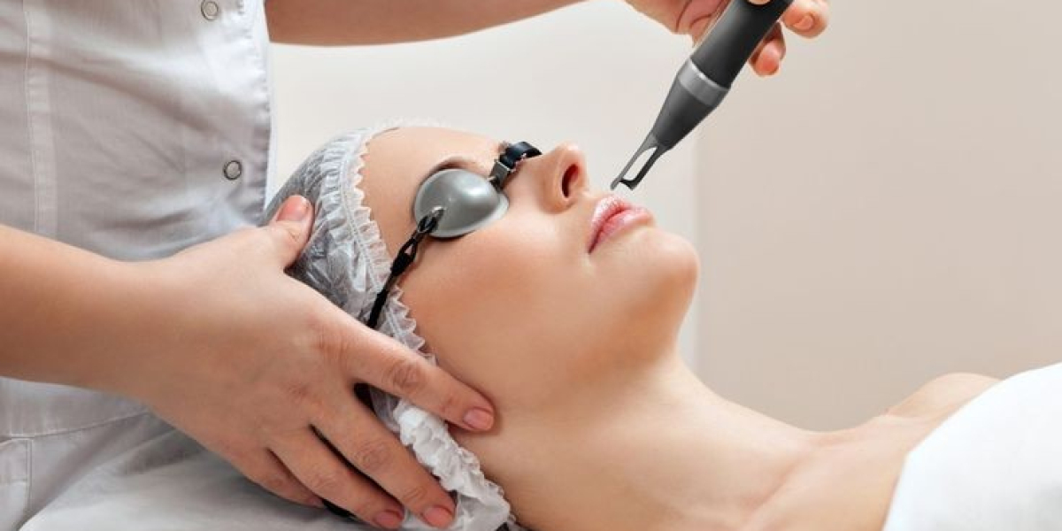 PICO Laser Treatment in Islamabad for Tattoo Removal: What to Expect