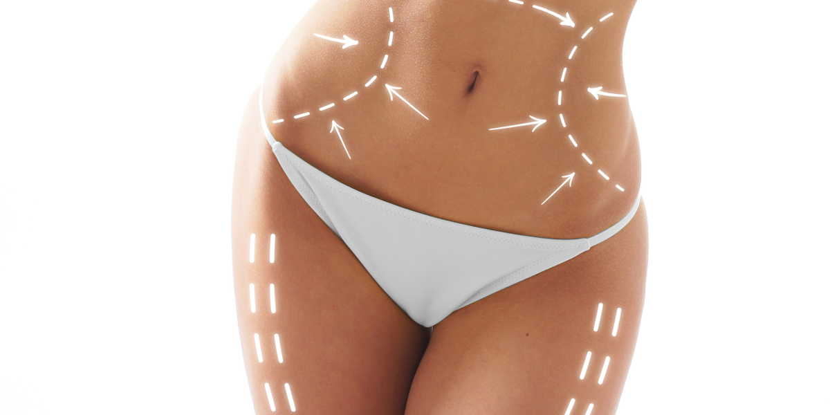 Latest Technology in Body Contouring in Islamabad