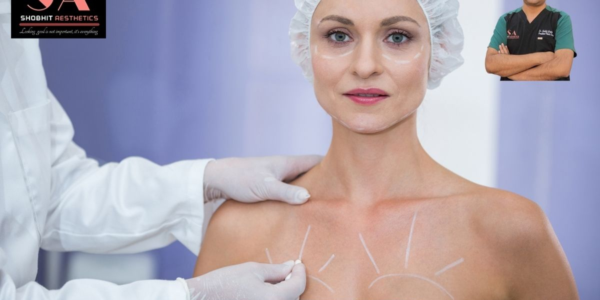 Breast Implant Surgery Cost in Delhi: A Complete, Honest Guide by a Plastic Surgery Expert