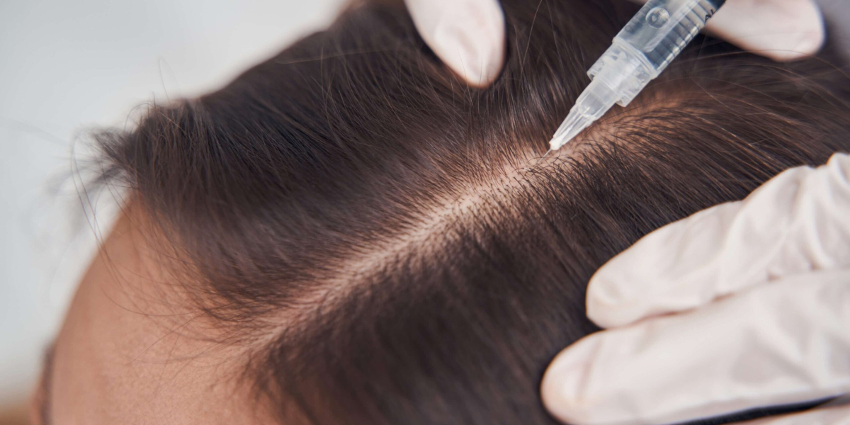 How Can Hair Transplantation Help Men and Women Regain Their Hair Confidence?:
