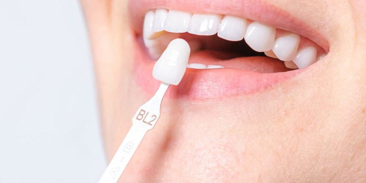 Dental Implants in Islamabad for Seniors: What to Know