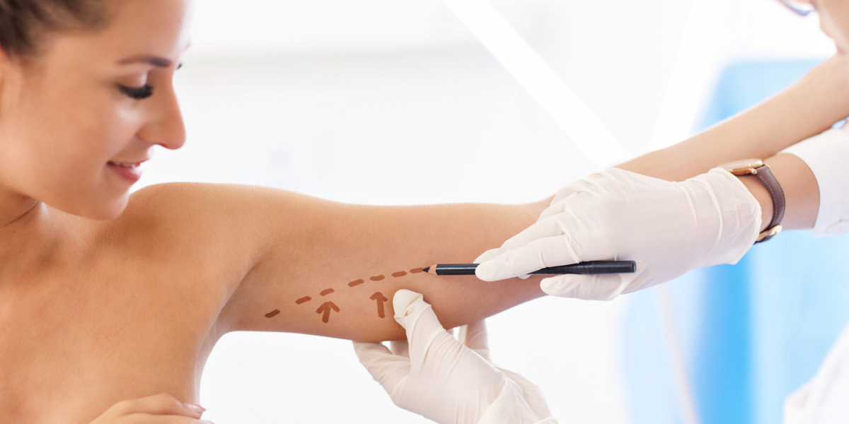 Arm Lift Surgery Recovery Timeline: What to Expect in Islamabad