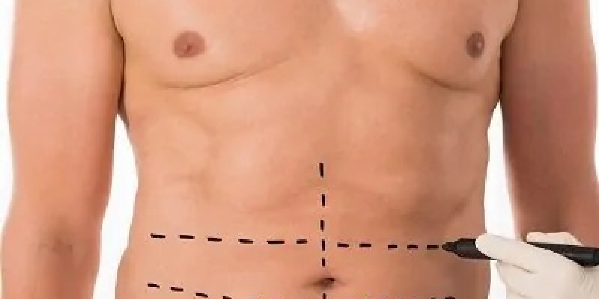 Recover Faster with Body Jet Liposuction in Islamabad