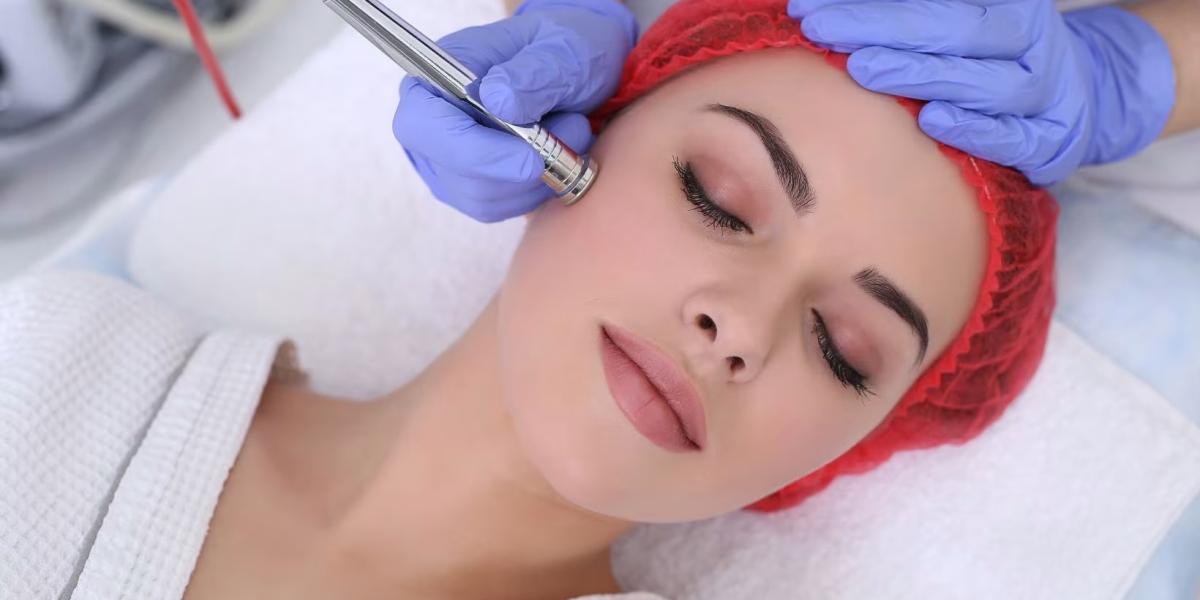 Microdermabrasion Treatment in Delhi (Diamond Skin Polishing): A Gentle Path to Brighter Skin
