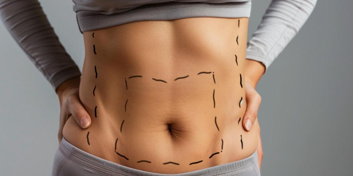 Before and After Results of Liposuction in Dubai