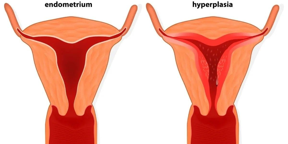 Normal Endometrial Thickness for Pregnancy | Dr Deepti Asthana