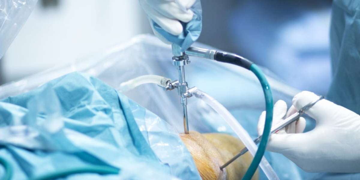 Arthroscopy Surgery Delhi: Accurate Diagnosis with Faster Healing