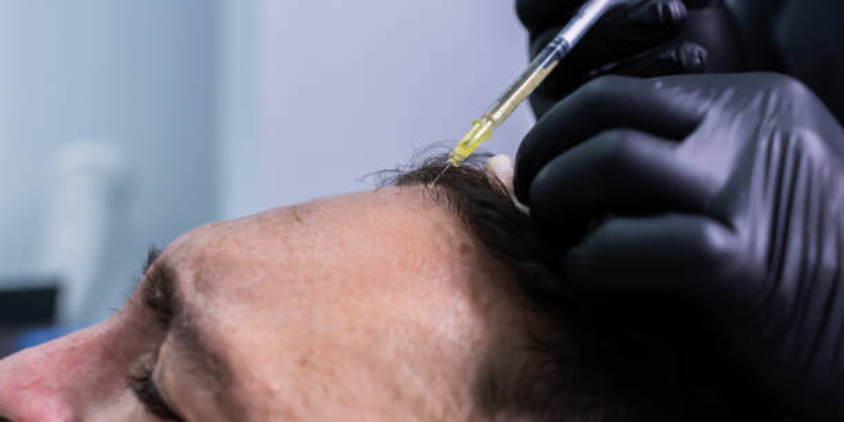 Is PRP Hair Therapy Safe? Common Side Effects and Risks