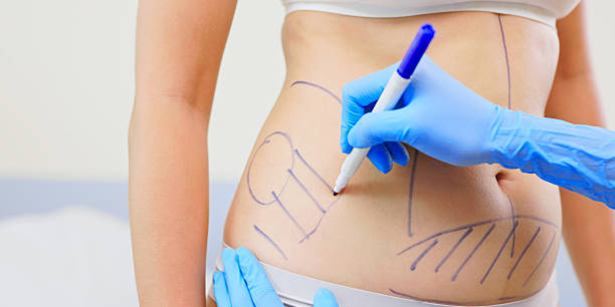 What Is Water-Assisted Liposuction Procedure?