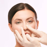 Rhinoplasty in Riyadh