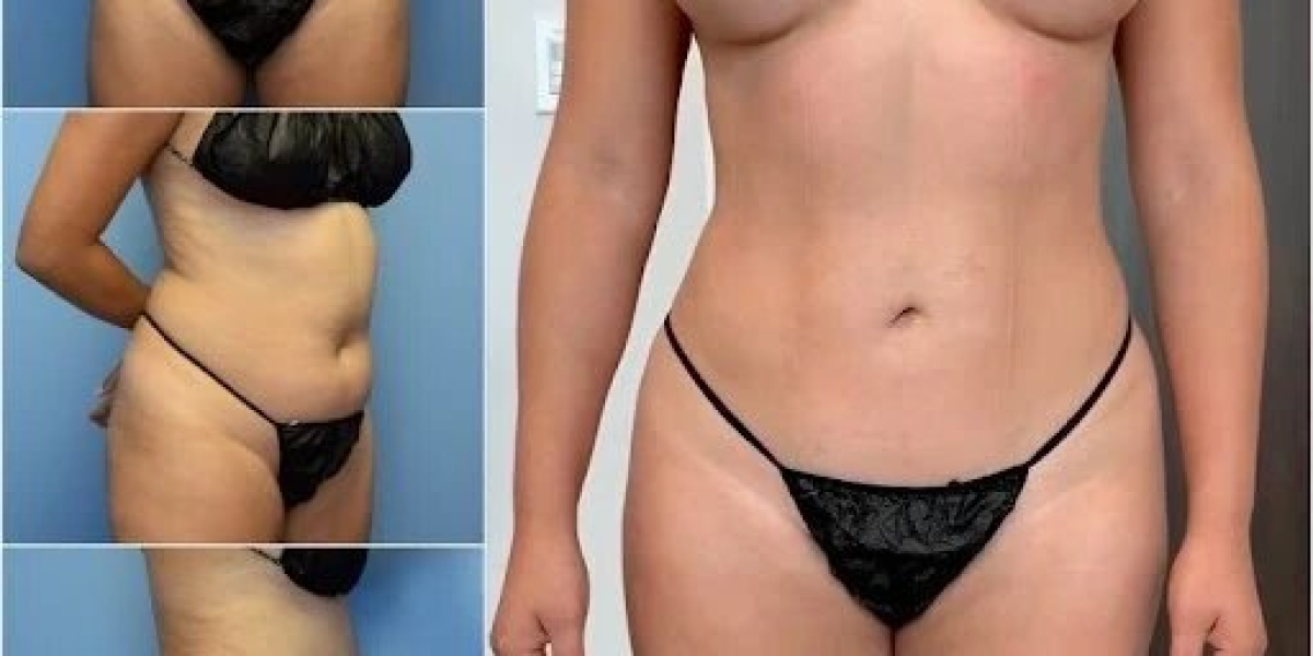 Best Doctors in Dubai for Body Contouring Offering Customized Sculpting